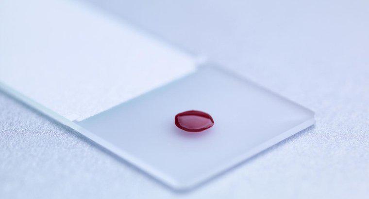 Ce este un test de sange LDH?