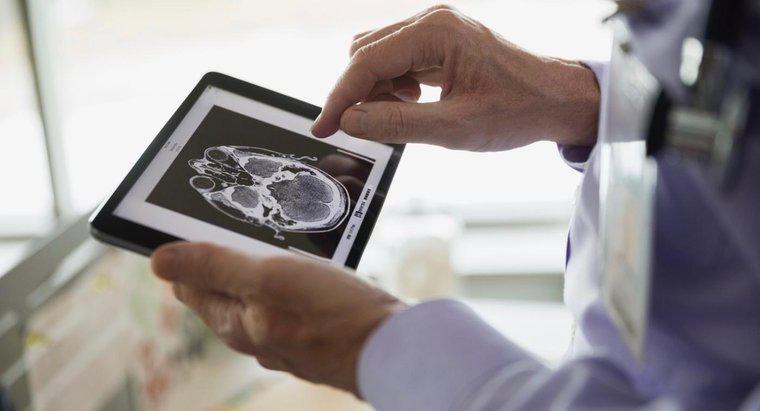 Care este prognoza unui pacient cu o tumora de laba frontală?