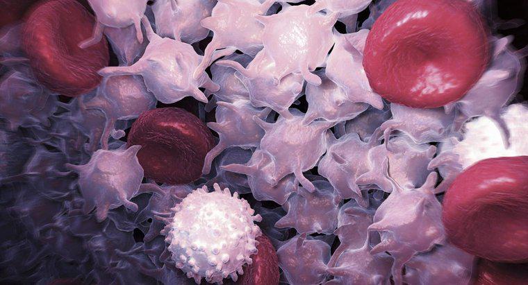Ce poate consta numarul mare de celule albe din sange?