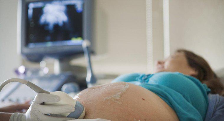 Cand un ultrasunete arata genul unui bebelus?