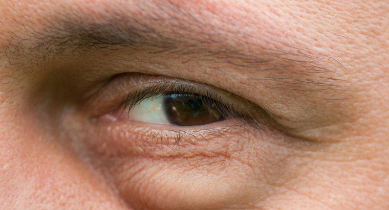 Care sunt posibilele cauze ale umflarii sub ochi?