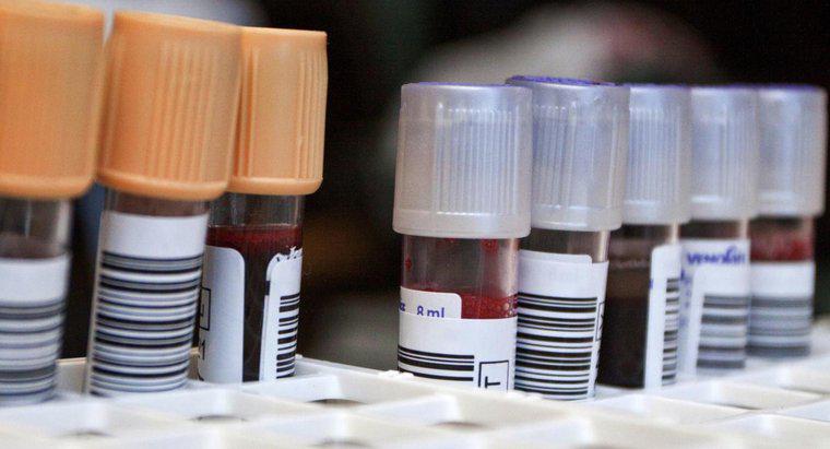 Ce este un test de sange cu neutrofile?