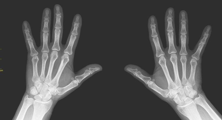 Care sunt numitele oasele degetului și degetelor?