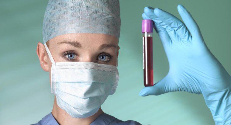 Care sunt condițiile care pot fi determinate de un test de sânge pentru anioni?