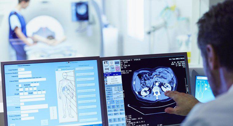 Cât durează să obțină rezultatele scanării CT?
