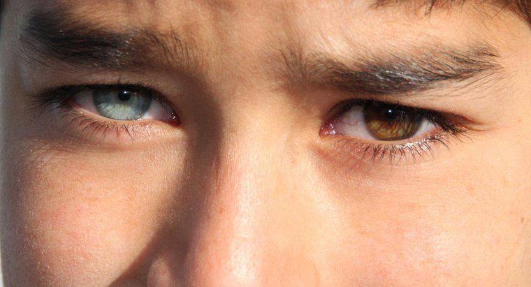 Cât de rară este heterochromia la oameni?