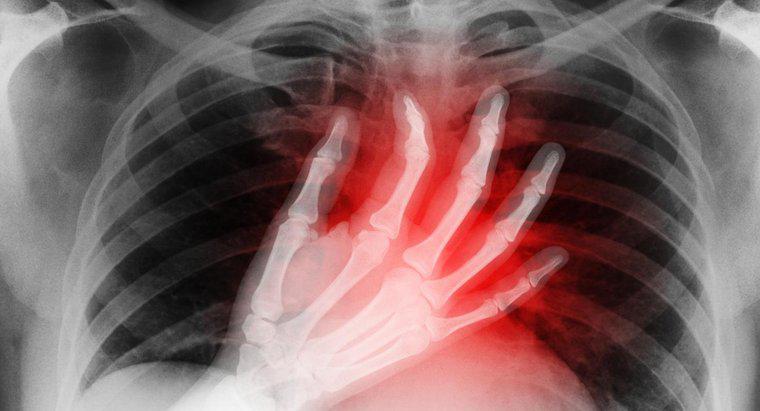 Care sunt simptomele unui atac de inima mini?