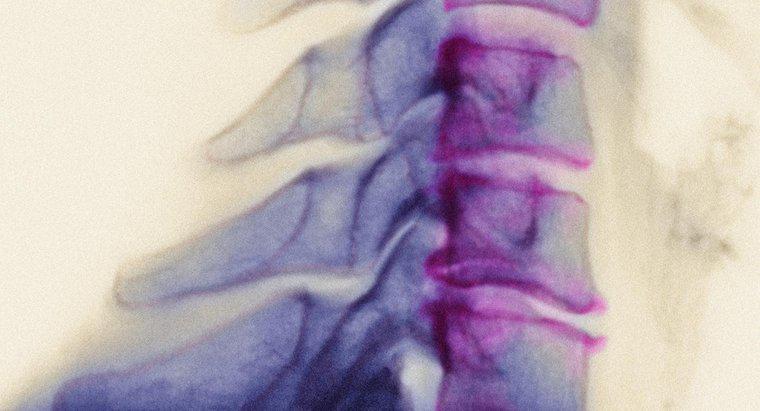 Ce este lipirea osteofatică?