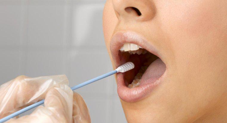 Cat de precise sunt testele de droguri cu tampon de gura?