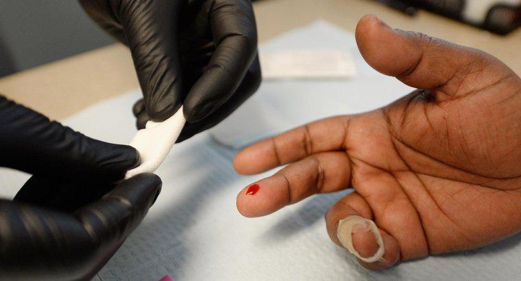 Cât timp durează pentru ca HIV să apară pe teste?