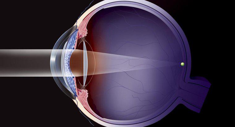 Ce este timpul standard de recuperare după operația de cataractă?