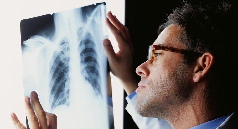 Cum este tratată o infecție pulmonară?