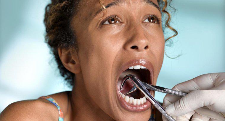 Cum tratezi o infecție după extracția dinților?