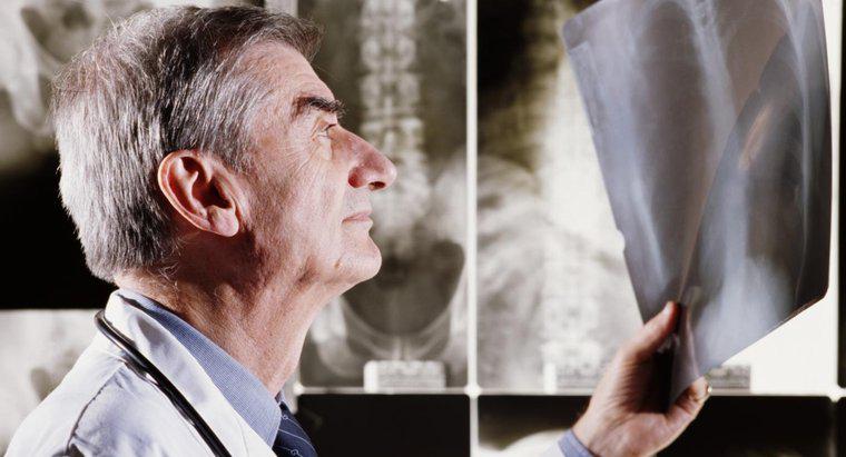 Care sunt dezavantajele X-Rays?
