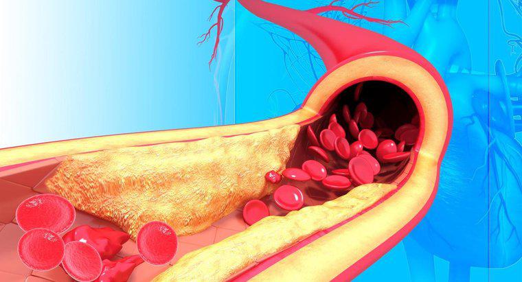 Care este structura arterelor?