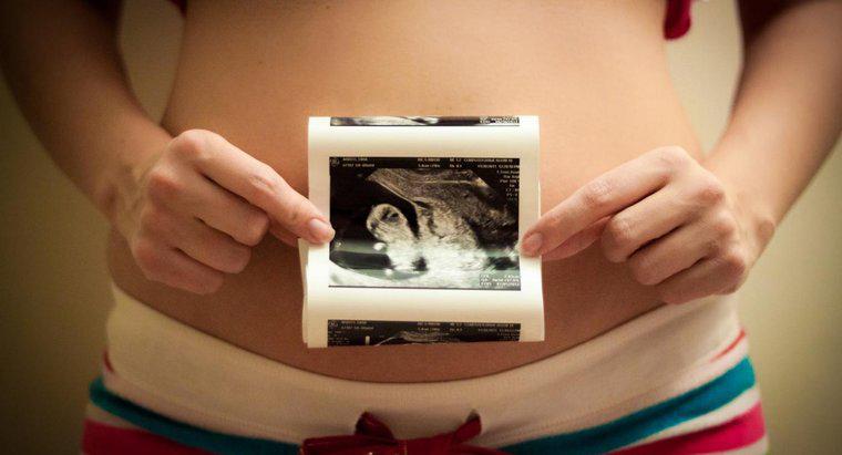 Care este ordinea corectă a etapelor dezvoltării prenatale?