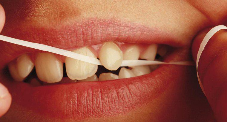 Ce este din ața dentară?