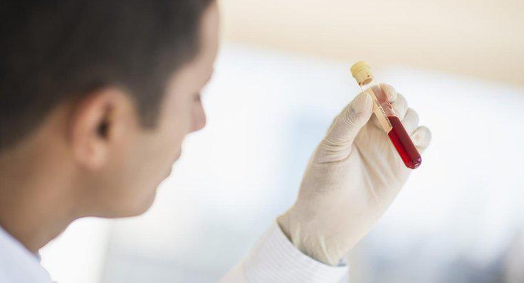 Ce este un test de sânge pe oase profil?