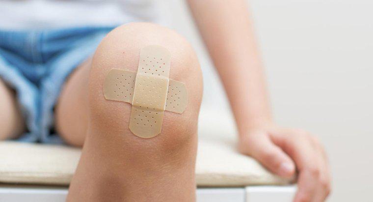 Ce cauzeaza dureri de genunchi si umflarea?