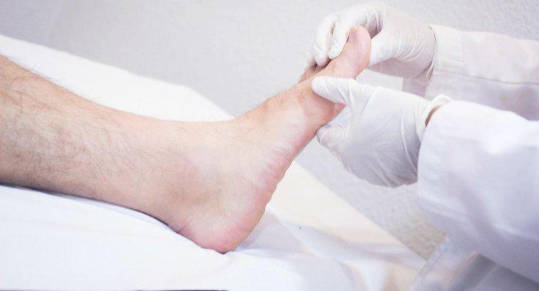 Care sunt riscurile pentru sănătate implicate în picioarele umflate?