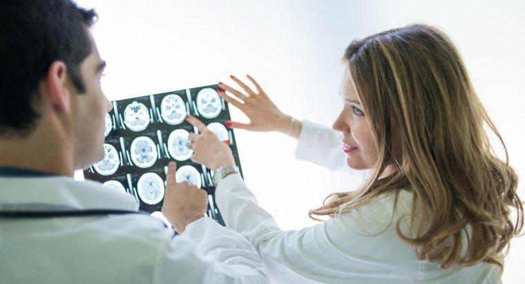 Care sunt unele simptome ale unei tumori cerebrale?