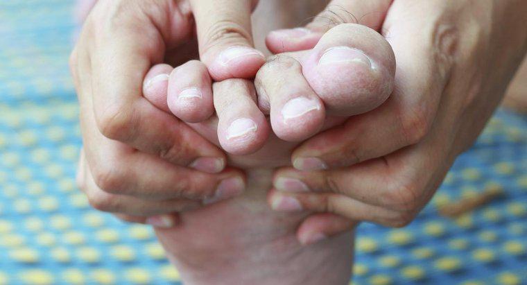 Cum scapi de durere de la porumb între degetele de la picioare?