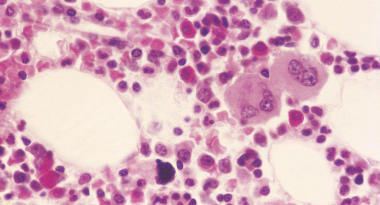 Care sunt cauzele pentru mielocitele din sânge?