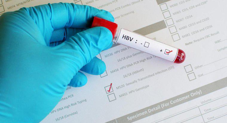 Ce indică un rezultat pozitiv într-un test de bază al hepatitei B?