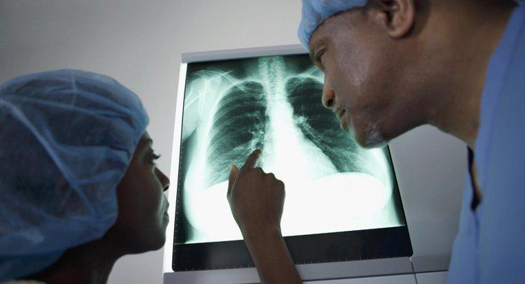 Ce înseamnă o masă pe pulmonar?