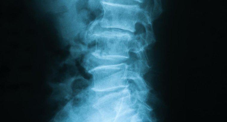 Ce este coloana vertebrală toracolumbară?