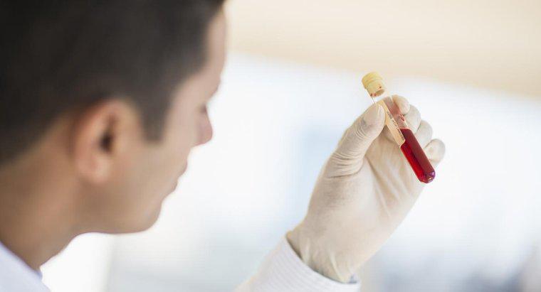 Cât de multe ore aveți nevoie pentru a efectua rapid un test de sânge?