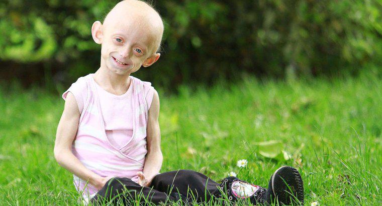 Care sunt câteva fapte interesante despre Progeria?
