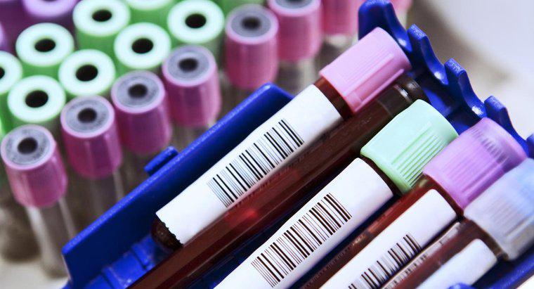 Ce sunt abrevieri obișnuite la un test de sânge?