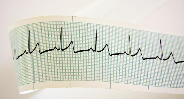 Ce cauzează o bătăi cardiace rapide?