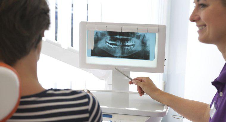 Care sunt avantajele și dezavantajele implanturilor mini dentare?