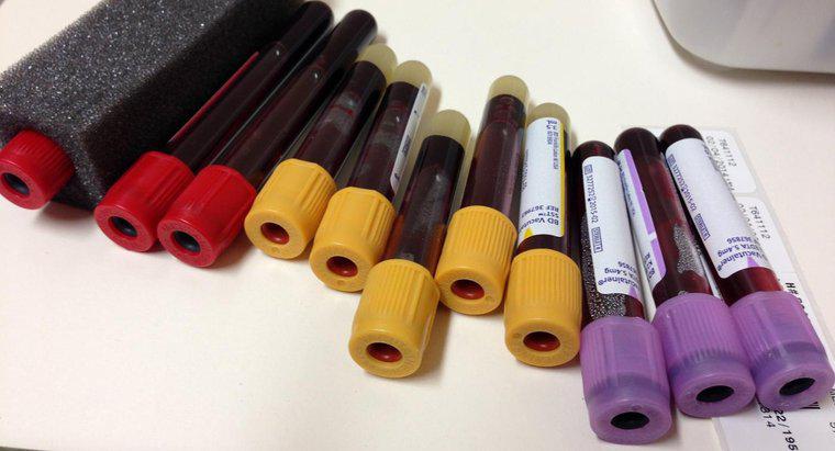 Ce nivel de feritină într-o măsură de testare a sângelui?