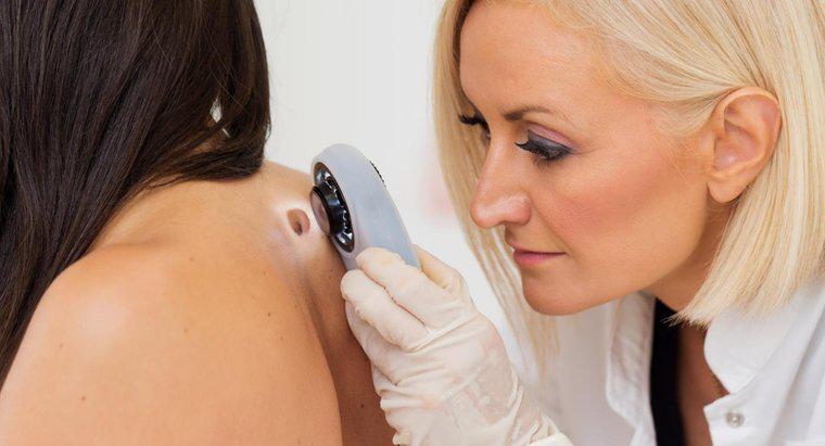 Ce site-uri medicale afișează imagini ale tipurilor de cancer de piele?