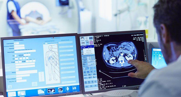 Care sunt avantajele și dezavantajele scanărilor CT?