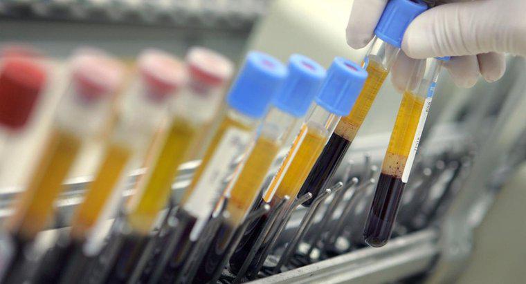 Ce este HCT într-un test de sânge?