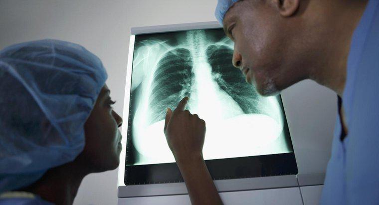 Ce este o umbra pe pulmonar?