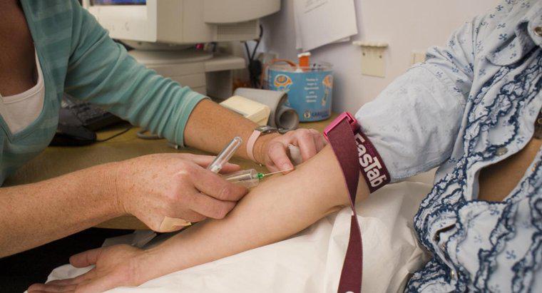 Ce este un test SEG de sânge?