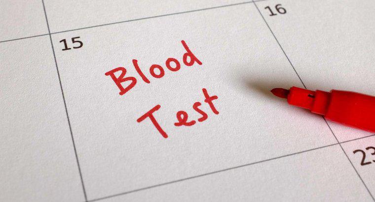 Ce este un test de sânge CA 125?