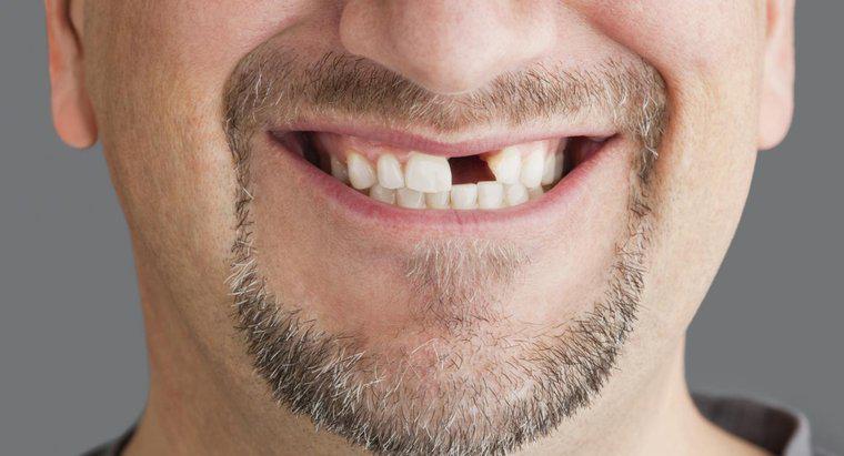 Care sunt principalele etape ale unei proceduri de extragere a dintelui frontal?
