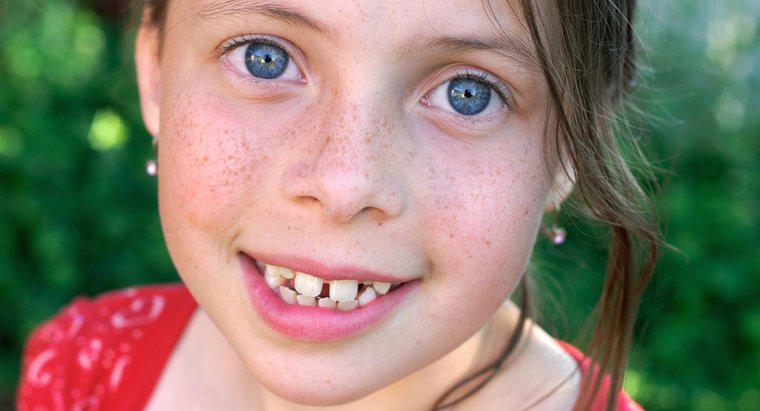 Sunt Freckles o trăsătură dominantă sau recesivă?