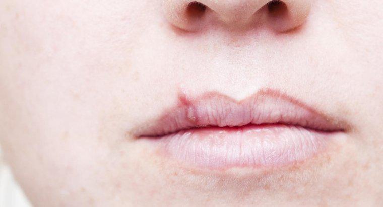 Care este primul semn al cancerului de buze?