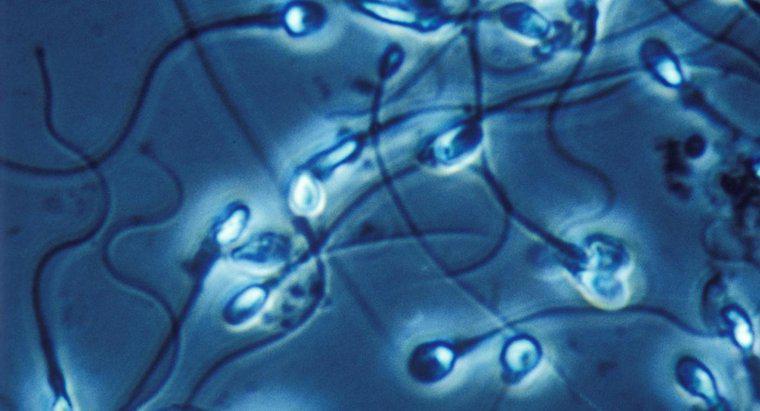 Care sunt tratamentele pentru morfologia anormală a spermei?