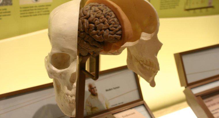 Ce indică ventriculele creierului mărit?