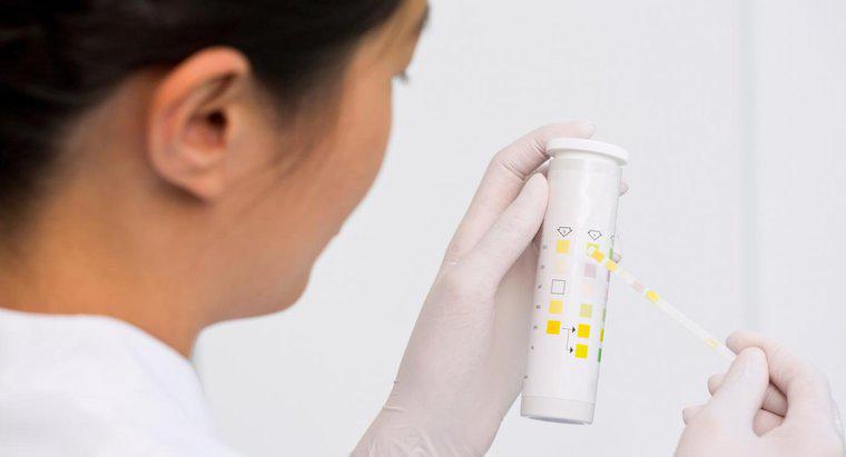 Ce este testul microalbuminic pentru urină pentru diabet?