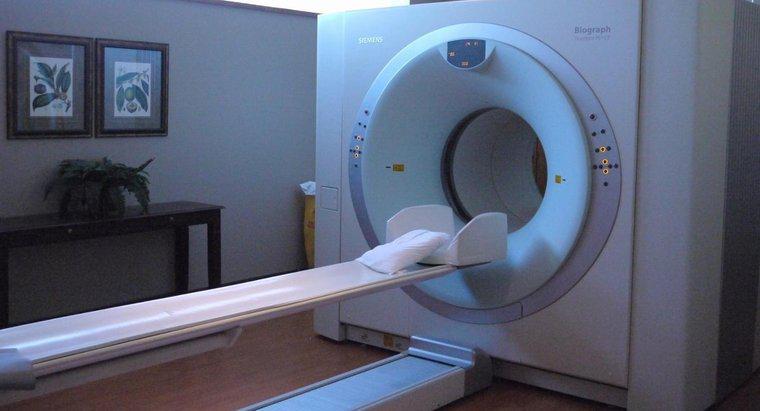Ce arată scanarea CT?