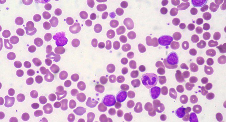 Ce este un număr normal de hemoglobină?